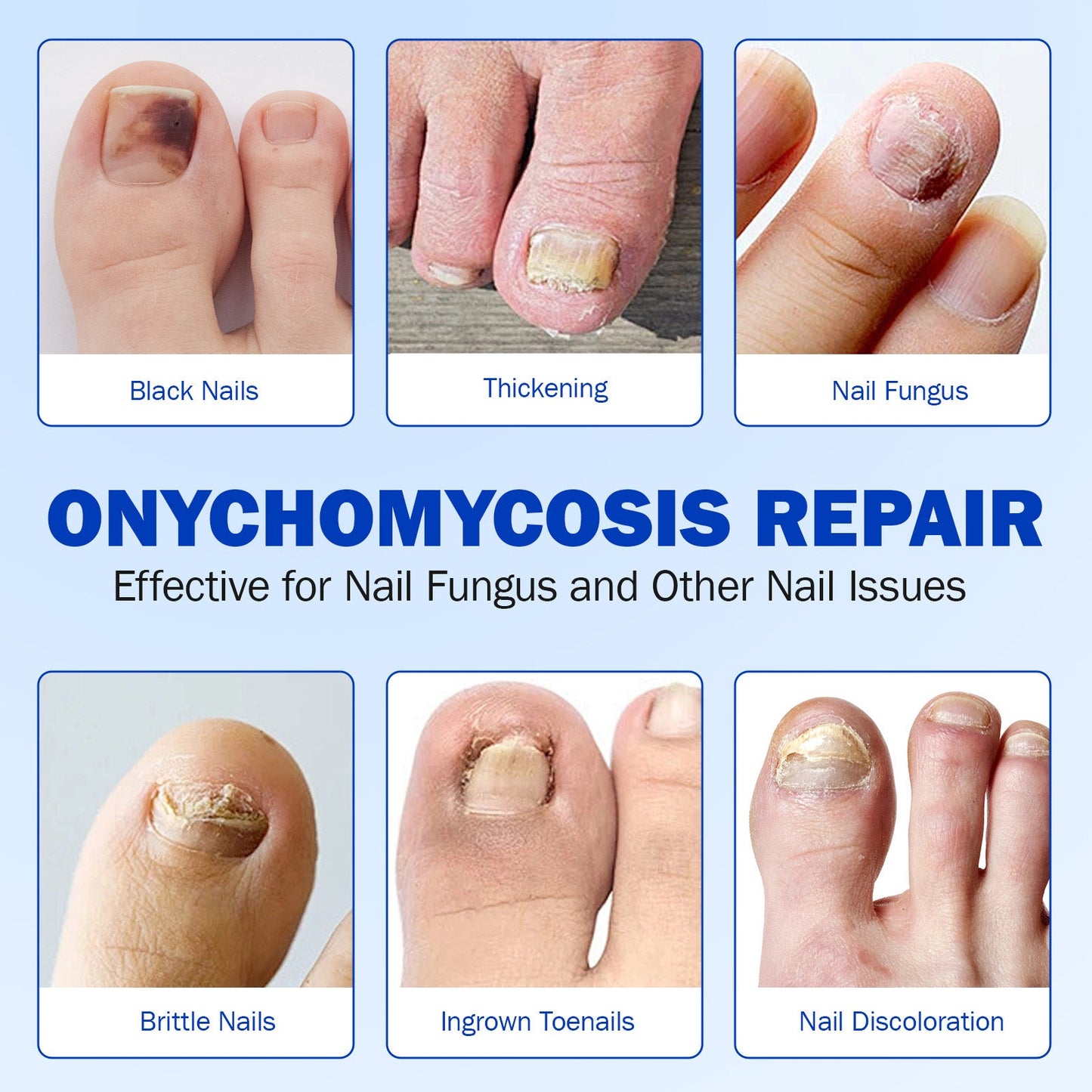 FungGone – Nail Repair Patches
