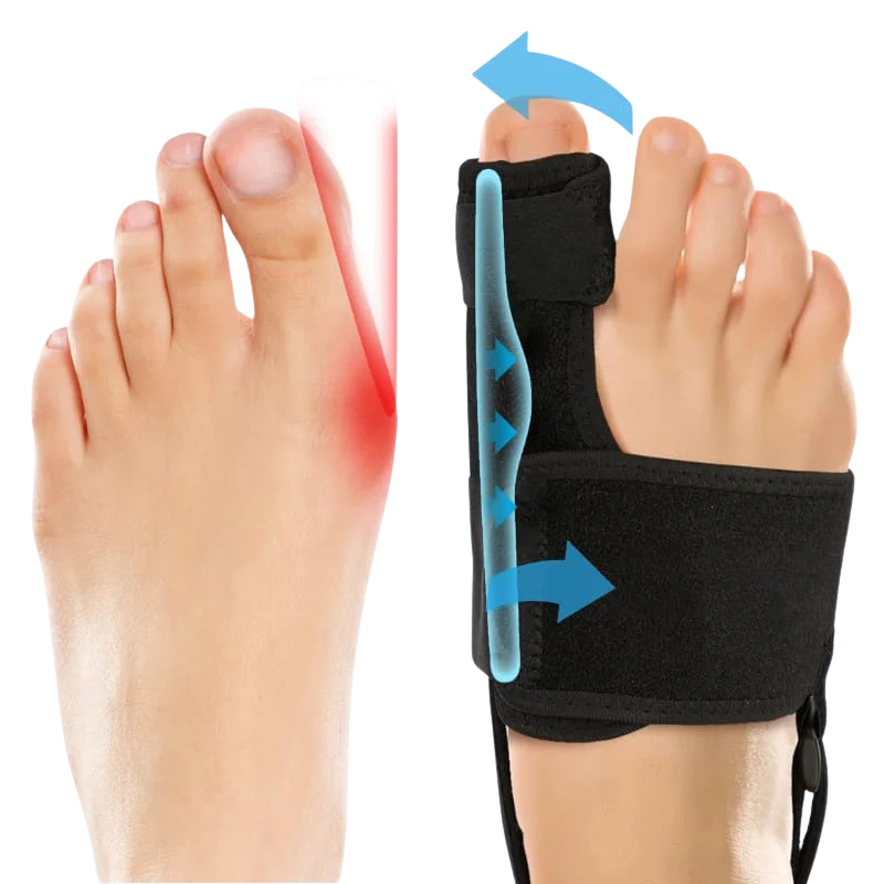 NVB™ Footreez Bunion Brace – For Pain-Free Walking